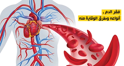 فقر الدم : أنواعه وطرق الوقاية منه