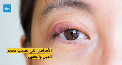 الأمراض التي تصيب محجر العين والجفون