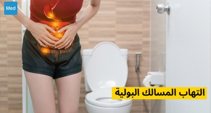 التهاب المسالك البولية