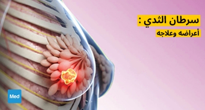 سرطان الثدي : أعراضه وعلاجه