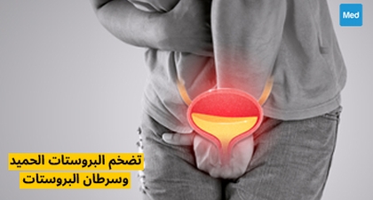 تضخم البروستات الحميد وسرطان البروستات