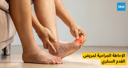 الإحاطة الجراحية لمريض القدم السكري