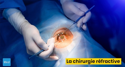 Se débarrasser des lunettes : Quelle technique choisir ? Le point de vue du chirurgien