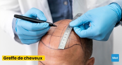 La Greffe de Cheveux : Restaurer la Beauté Naturelle et la Confiance en Soi