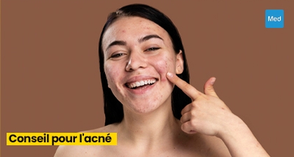 L'Acné : Conseils Pratiques pour une Peau Claire