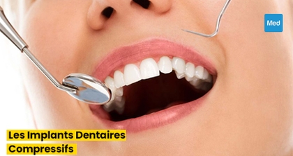 Sourire Confiant : Tout ce que Vous Devez Savoir sur les Implants Dentaires Compressifs
