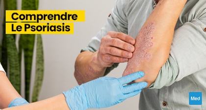 Comprendre le Psoriasis : Démystification d'une Maladie Courante
