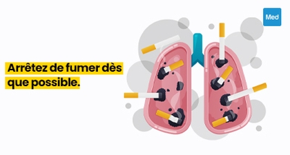 Les dangers du tabagisme et comment arrêter 