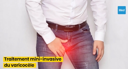 Le Traitement Mini-Invasif du Varicocèle : Une Révolution pour la Santé Masculine