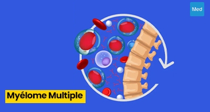 Myélome Multiple : Comprendre, Traiter, et Vivre Mieux