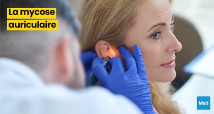 La Mycose Auriculaire de l'Oreille : Symptômes, Diagnostic et Traitement