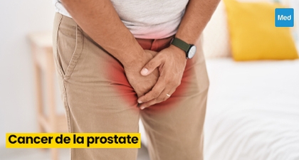 Comprendre et Gérer le Cancer de la Prostate 