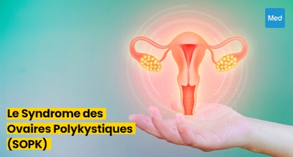 Tout ce que vous devez savoir sur le Syndrome des Ovaires Polykystiques (SOPK)