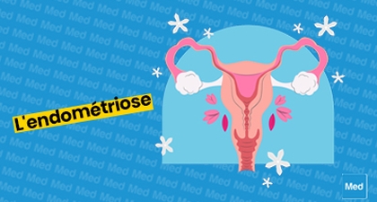 Comprendre l'Endométriose : Symptômes, Diagnostic et Options de Traitement