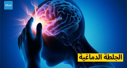 الجلطة الدماغية: التشخيص والعلاج والوقاية