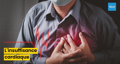 Tout ce que vous devez savoir sur l'Insuffisance Cardiaque