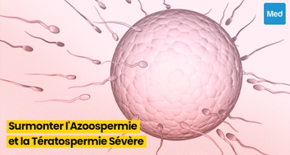 Congélation de Sperme : L'Espoir pour Surmonter l'Azoospermie et la Tératospermie Sévère