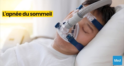 Comprendre l'apnée du sommeil : Le souffle qui se brise dans la nuit