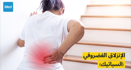 الإنزلاق الغضروفي (السياتيك): الأسباب والأعراض والتشخيص والعلاج