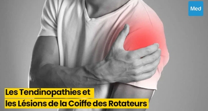 Comprendre et Gérer les Tendinopathies et les Lésions de la Coiffe des Rotateurs