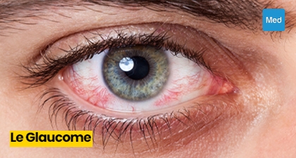 Comprendre le Glaucome : Enjeux, Symptômes et Prévention