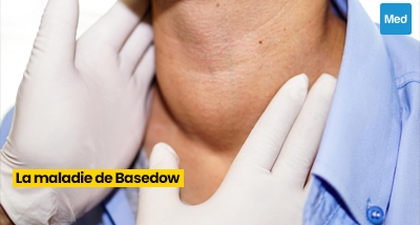 La Maladie de Basedow : Comprendre, Gérer, Vivre