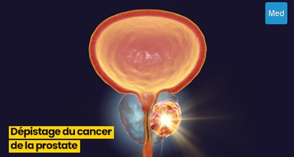 Comprendre le Dépistage du Cancer de la Prostate : Informations Essentielles pour les Hommes