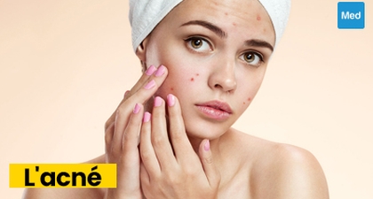 Comprendre l'Acné