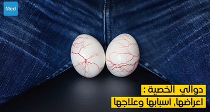 دوالي الخصية : أعراضها، أسبابها وعلاجها