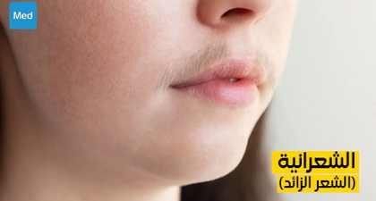 فهم الشعرانية (الشعر الزائد)