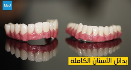 بدائل الأسنان الكاملة