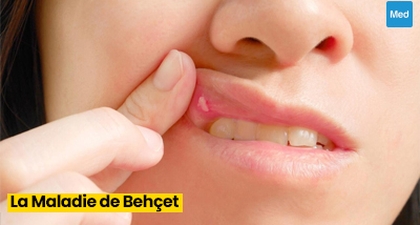 La Maladie de Behçet