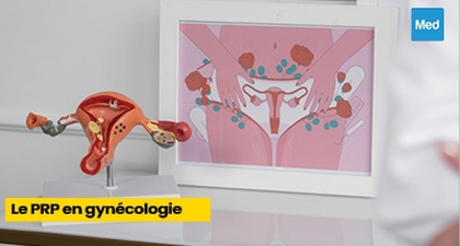 Le PRP en gynécologie : une nouvelle approche thérapeutique