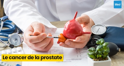 Cancer de la prostate