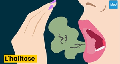 Halitose : causes, symptômes, diagnostic et traitement