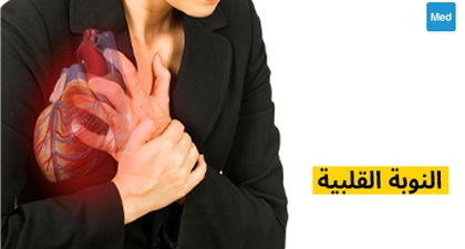 النوبة القلبية 