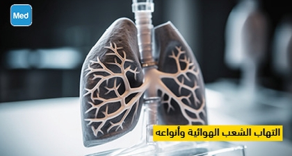 التهاب الشعب الهوائية وأنواعه