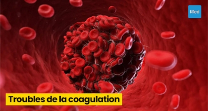 Troubles de la coagulation