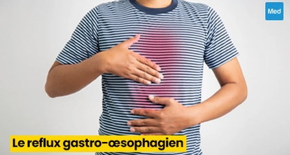 Reflux gastro-œsophagien (RGO) : causes, symptômes et traitement