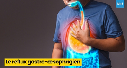 Le Reflux Gastro-Œsophagien (RGO) : comprendre et soulager ce trouble digestif fréquent