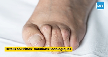Orteils en Griffes : Solutions Podologiques