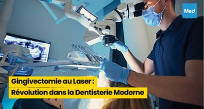Gingivectomie au Laser : Révolution dans la Dentisterie Moderne