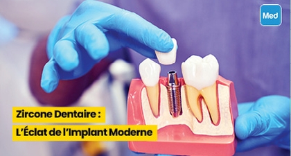 Zircone Dentaire : L'Éclat de l'Implant Moderne