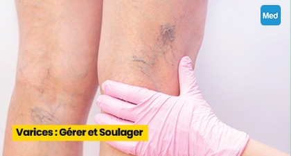 Varices : Gérer et Soulager