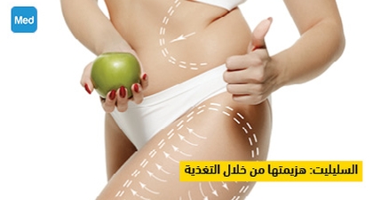 السليليت هزيمتها من خلال التغذية
