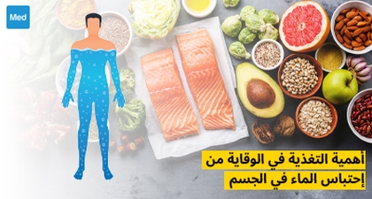 أهمية التغذية في الوقاية من احتباس الماء في الجسم
