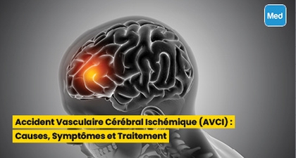 Accident Vasculaire Cérébral Ischémique (AVCI) : Causes, Symptômes et Traitement