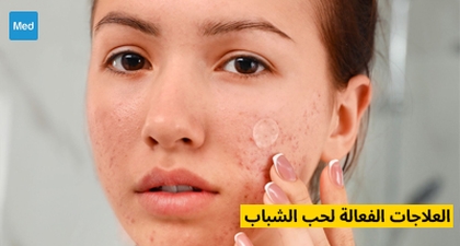 العلاجات الفعالة لحب الشباب