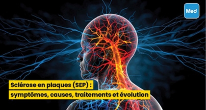 Sclérose en plaques (SEP) : symptômes, causes, traitements et évolution