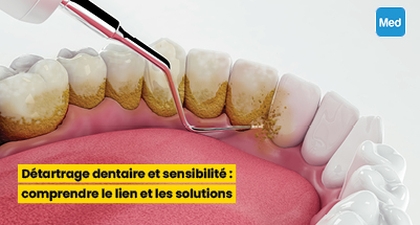 Détartrage dentaire et sensibilité : comprendre le lien et les solutions
